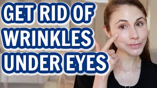 How to GET RID OF UNDER EYE WRINKLES Dr Dray [upl. by Fabri]