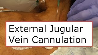 External Jugular Vein Cannulation [upl. by Powe]