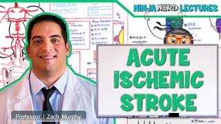 Acute Ischemic Stroke Etiology Pathophysiology Clinical Features Diagnostics Treatment [upl. by Hayn955]