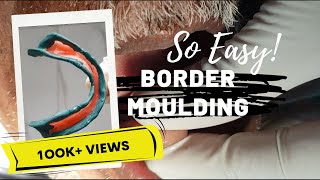 Mandibular Border Moulding Made Easy [upl. by Alan]