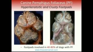 Pemphigus Foliaceus – Recent update on Pathogenesis Diagnostic and Treatment [upl. by Lugo]