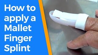 How to apply a Mallet Finger Splint [upl. by Amsed]