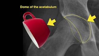 Anatomy of Hip Xrays [upl. by Aisnetroh]