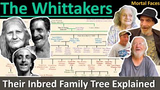 THE WHITTAKERS A West Virginia Inbred Family Tree Explained Mortal Faces [upl. by Atinel]