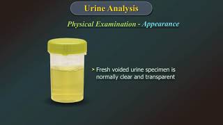 Urine Analysis [upl. by Janessa]