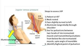 Jugular venous pulse clinical aspects [upl. by Lorrin]