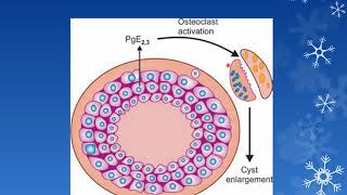 ODONTOGENIC CYSTS PART 1 Oral Pathology  3rd BDS [upl. by Niamert]