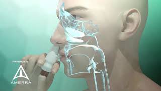 Fluticasone nasal spray Flonase  3D medical animation [upl. by Condon104]