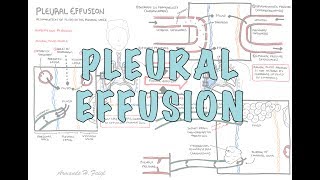 Pleural Effusion DETAILED  pathophysiology signs and symptoms treatment [upl. by Dolora]