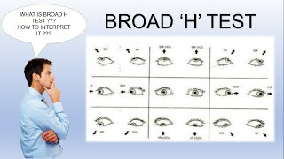 Broad H Test  Ocular Motility Test [upl. by Torras986]