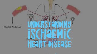 The pathophysiology of ischaemic heart disease [upl. by Adlay]