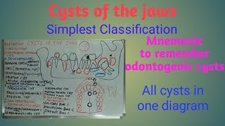 Cysts of the jaws  definition classification origin and location [upl. by Ahsenahs]