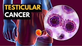 Testicular Cancer Causes Signs and Symptoms Diagnosis and Treatment [upl. by Blakelee]