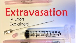 Extravasation  IV Infiltration Errors Explained Doctor Interview [upl. by Gareri669]