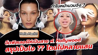 VLOG 192 กินเข็มแทนข้าว  ฉีดฟิลเลอร์ทั้งหน้า แบบ bellahadid สายฝอ Hollywood  ดีจริงมั้ยต้องดู [upl. by Konstantine209]