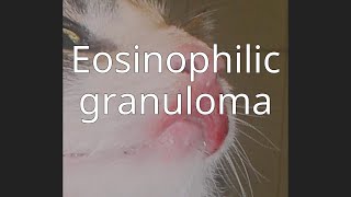 Eosinophilic granuloma [upl. by Sadella]