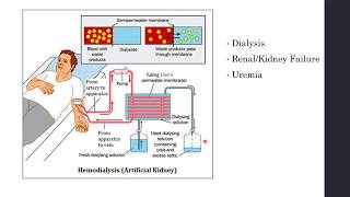 Disorders of Excretory System  Haemodialysis Artificial Kidney  Biology Class 11NEET [upl. by Sitruc375]