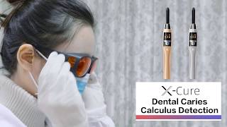 XCure Dental Caries Calculus Detection [upl. by Caruso]