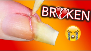 MY LIFE IS OVER I AM BROKEN  Fixing my broken nail [upl. by Ilrahc]