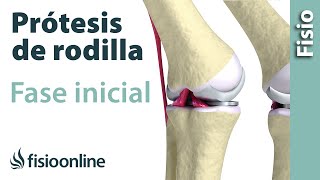 Rehabilitación de prótesis de rodilla  Primera fase [upl. by Bunting447]