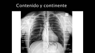 evaluacion de radiografia de torax [upl. by Eeralih]