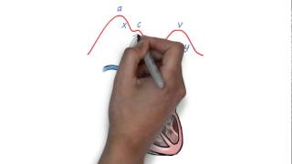 JVP waveform explained [upl. by Arrehs]