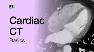 Cardiac CT Basics [upl. by Marron]