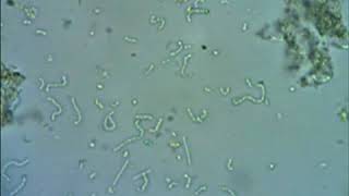 Bacterias del yogurt Observacion real al microscopio [upl. by Siloa]