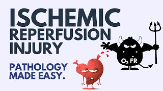 Ischemic Reperfusion Injury Pathology  Explained Simply 2024 [upl. by Valeria598]