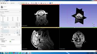 3 3D Slicer  Rotate MRI to 3D Slicer Orientation [upl. by Ierbua735]