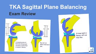 TKA Sagittal Plane Balancing Exam Review  Ron Delanois MD [upl. by Rahsab]