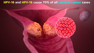 Human Papillomavirus HPV [upl. by Dottie]