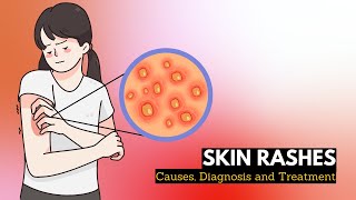 Skin Rash Causes Signs and Symptoms Diagnosis and Treatment [upl. by Branca]