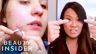 How To Pop A Pimple Yourself With Dr Pimple Popper  Beauty At Home [upl. by Janyte]