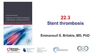 223 Stent Thrombosis Manual of PCI [upl. by Novyar]