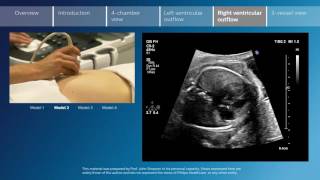 Key screening views of the fetal heart  Part 5  Right ventricular outflow [upl. by Nnad]