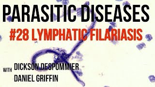 Parasitic Diseases Lectures 28 Lymphatic Filariasis [upl. by Arsuy298]