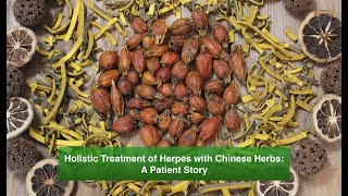 Holistic Treatment of Herpes with Chinese Herbs A Patient Story [upl. by Yaral63]