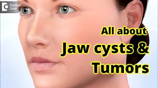 Jaw Cysts amp Tumors Diagnosis amp Treatment  Dr Girish Rao [upl. by Soph]