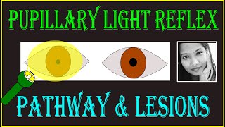 Pupillary Light Reflex – Pathway amp Lesions  Neuro ophthalmology [upl. by Pineda]