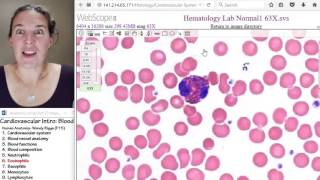 Blood 6 Eosinophils [upl. by Nichy746]