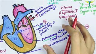 Mayo Clinic – Tetralogy of Fallot [upl. by Enra326]