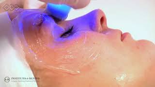 Exilis Ultra 360º  Aparatologia Facial [upl. by Adamis]