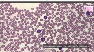 Immune Diagnostic Tests  WBCs Neutrophils ESR CRP Medical Surgical  Immune  LevelUpRN [upl. by Aneryc]