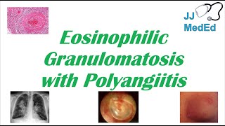 Learn about Eosinophilic Esophagitis EoE with Gus the Esophagus [upl. by Arjan]