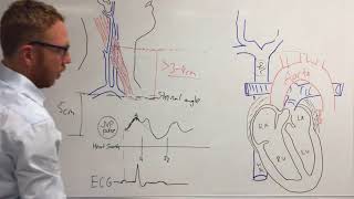 Jugular venous pressure [upl. by Onurb]