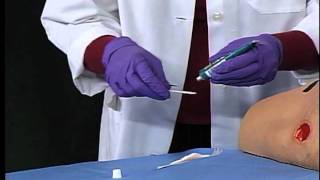 3M™ Tegaderm™ Hydrogel Wound Filler  Application and Removal [upl. by Doughman]